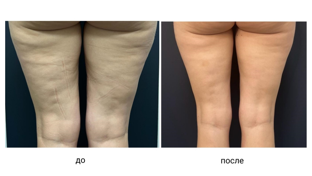 Копия Дизайн без названия (1).jpeg