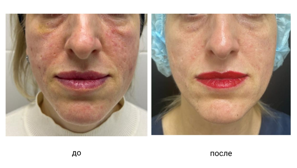 Дизайн без названия (3).jpeg Дизайн без названия (3).jpeg