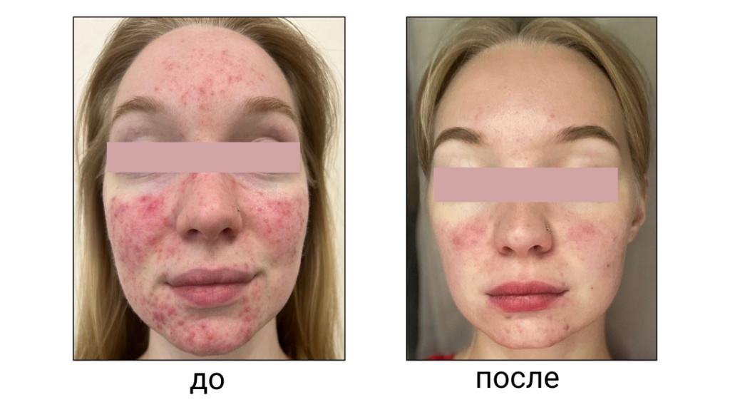 Дизайн без названия (1).jpeg Дизайн без названия (1).jpeg
